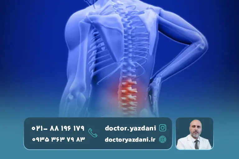 کاهش -درد-و-التهاب-در-ناحیه-دیسک-کمر